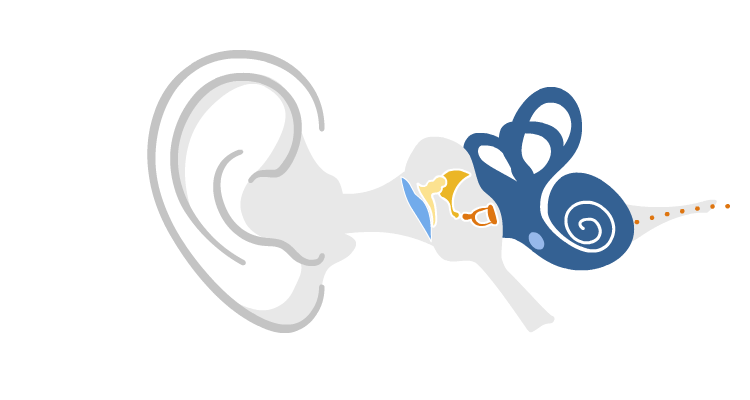 Sudden Sensorineural Hearing Loss (SSHL)